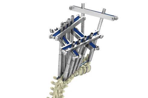 Bezpośrednia-derotacja-kręgów-CHARSPINE2-VD